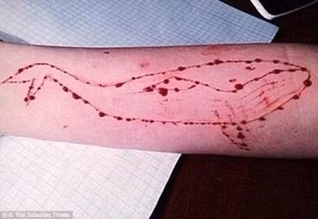 Nu sinh 15 tuoi nhap vien vi tham gia 