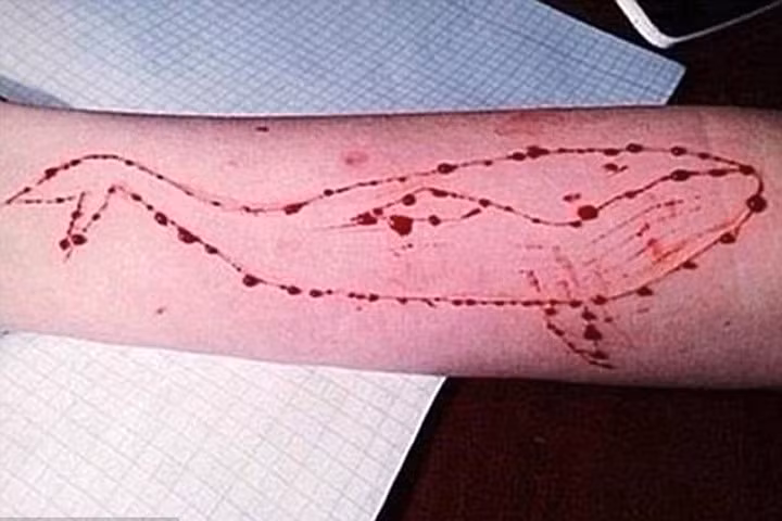 Nữ sinh 15 tuổi nhập viện vì tham gia "trò chơi tự tử" đáng sợ