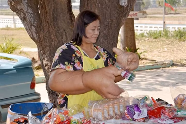 Với mỗi tay nặng đến gần 10kg, cô được tin là người có đôi bàn tay to nhất thế giới.