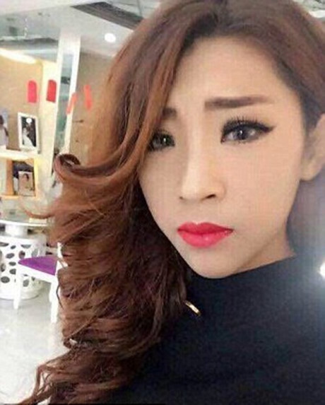 Kinh hoàng cô gái biến dạng mặt mày vì bị đánh ghen - Ảnh 5 Kinh hoang co gai bien dang mat may vi bi danh ghen - Anh 5