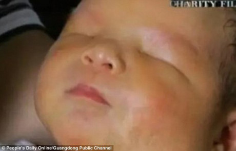 Bé sơ sinh chào đời với khuôn mặt... không có mắt - Ảnh 2 Be so sinh chao doi voi khuon mat... khong co mat - Anh 2