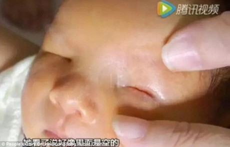 Bé sơ sinh chào đời với khuôn mặt... không có mắt - Ảnh 1 Be so sinh chao doi voi khuon mat... khong co mat - Anh 1