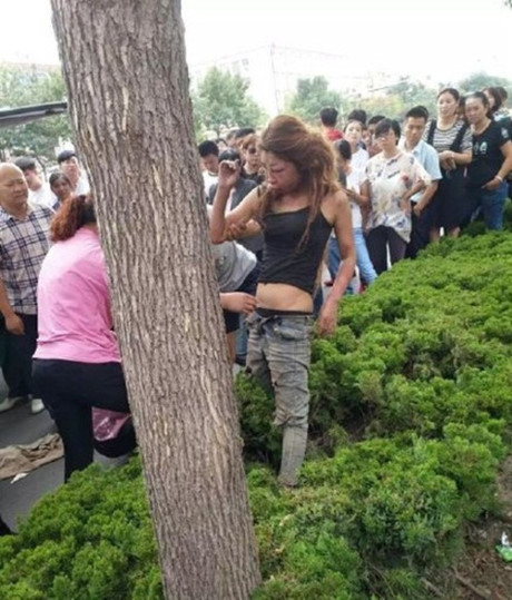 Kinh hoàng cô gái biến dạng mặt mày vì bị đánh ghen - Ảnh 3 Kinh hoang co gai bien dang mat may vi bi danh ghen - Anh 3