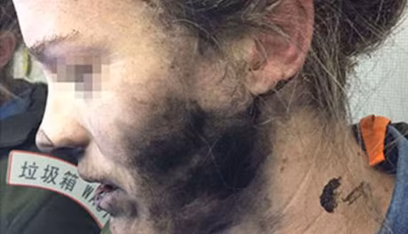 Tai nghe Bluetooth no tren may bay, mat hanh khach chay den - Anh 1