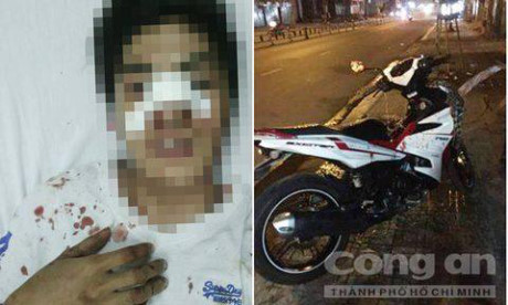 TP.HCM: 2 dân phòng kể lại giây phút đánh đuổi 7 tên cướp hung hãn - Ảnh 1 TP.HCM: 2 dan phong ke lai giay phut danh duoi 7 ten cuop hung han - Anh 1