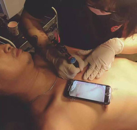 Bố xăm hình y hệt vết sẹo mổ của con - Ảnh 1 Bo xam hinh y het vet seo mo cua con - Anh 1