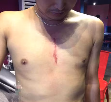 Bo xam hinh y het vet seo mo cua con - Anh 4