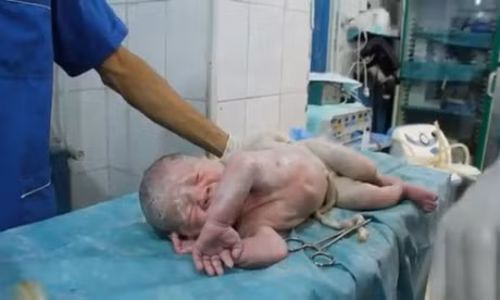 Hoi sinh em be chao doi voi trai tim ngung dap - Anh 1