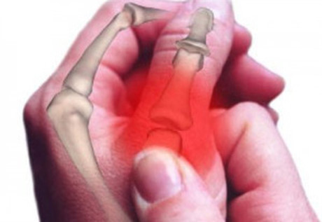 Bẽ khớp ngón tay, chân và hệ lụy khôn lường phái đẹp nên biết - Ảnh 1 Be khop ngon tay, chan va he luy khon luong phai dep nen biet - Anh 1