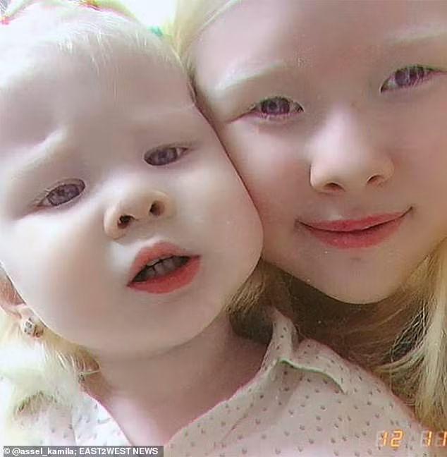 Diện mạo khác lạ của hai chị em người Kazakhstan bị bạch tạng gây 'sốt' - ảnh 6