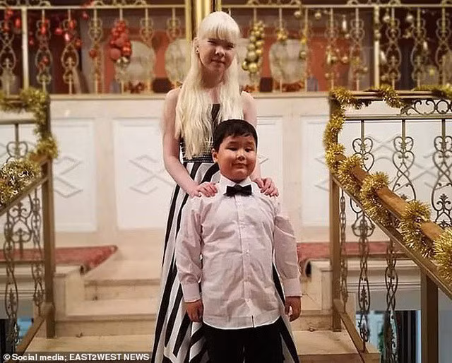 Diện mạo khác lạ của hai chị em người Kazakhstan bị bạch tạng gây 'sốt' - ảnh 7