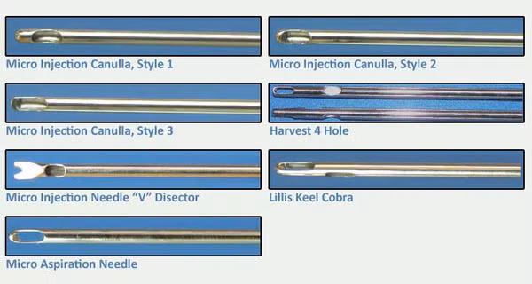 quy trình hút mỡ 