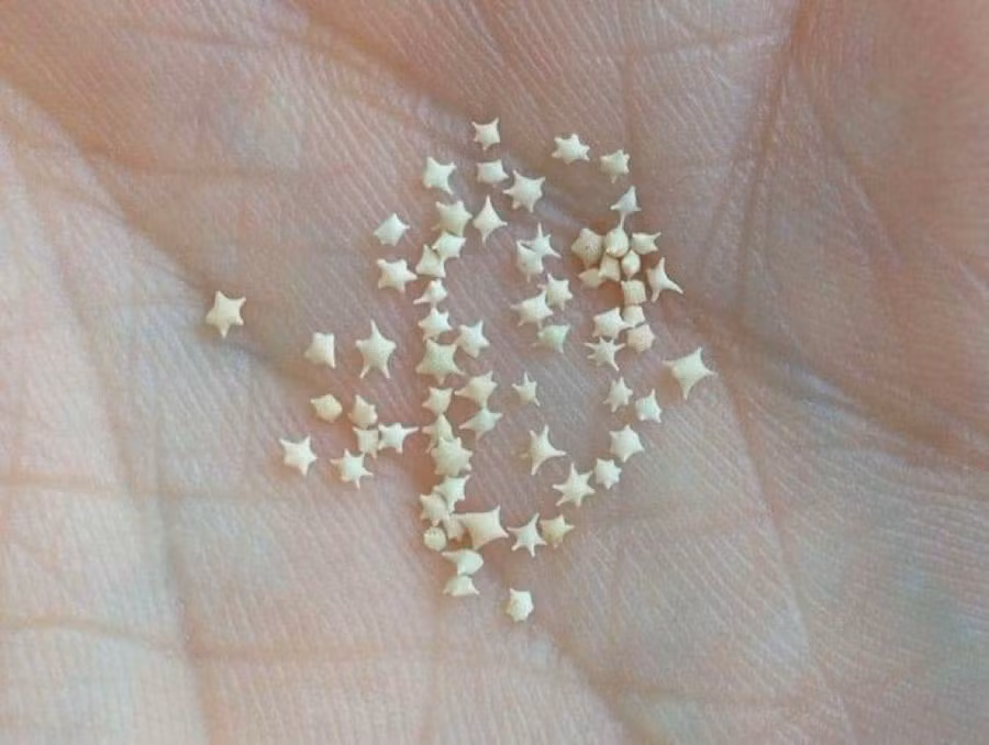 Kỳ lạ bãi biển có những hạt cát hình ngôi sao ảnh 1