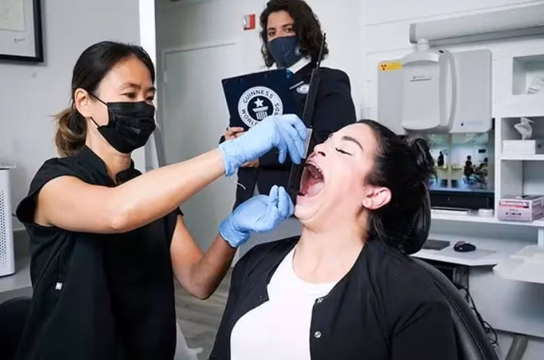 Sửng sốt trước người phụ nữ có miệng rộng nhất thế giới ảnh 3