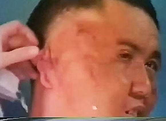 Kỳ lạ: Người đàn ông mọc thêm miệng và não trên mặt 1