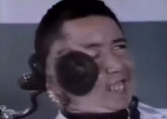 Kỳ lạ: Người đàn ông mọc thêm miệng và não trên mặt 0