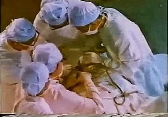 Kỳ lạ: Người đàn ông mọc thêm miệng và não trên mặt 3