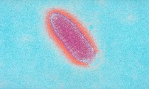 Hình ảnh hiển vi của virus gây bệnh dại (Rabdoviridae). Ảnh: Sanofi Pasteur/Flickr.