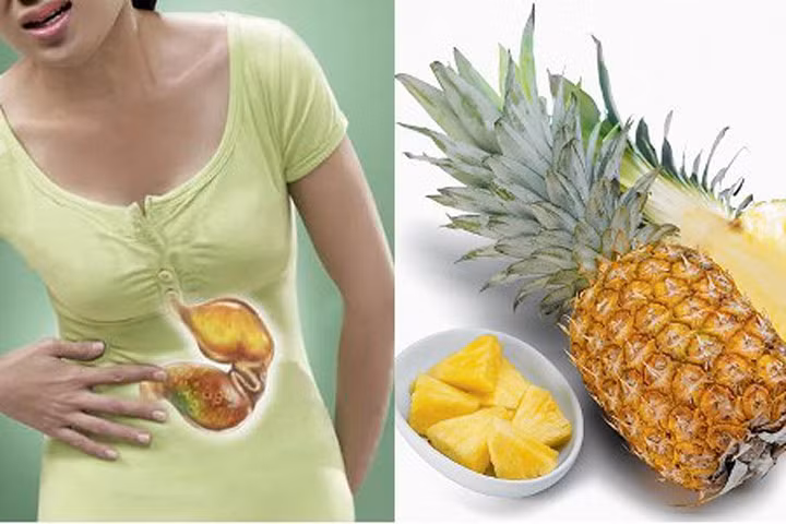 Bài thuốc dân gian "đánh tan" sỏi thận thần tốc chỉ từ quả dứa