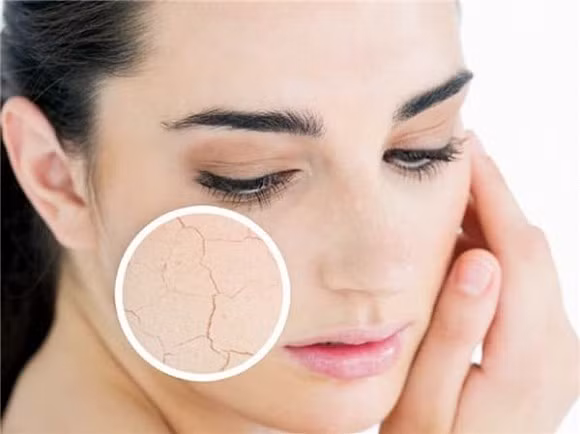 Không bổ sung đủ lượng nước có thể khiến da bị khô, thiếu sức sống. 