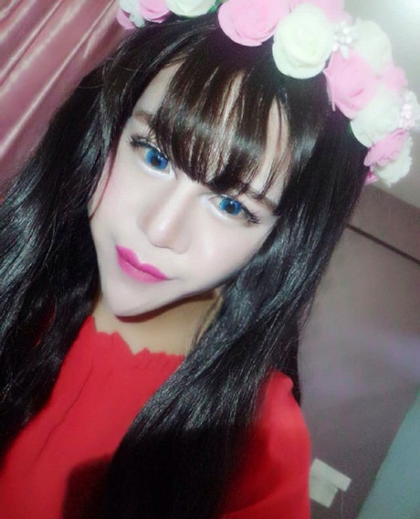 Cô gái TQ khiến mọi người sợ hãi vì khuôn mặt biến dị - Ảnh 3 Co gai TQ khien moi nguoi so hai vi khuon mat bien di - Anh 3