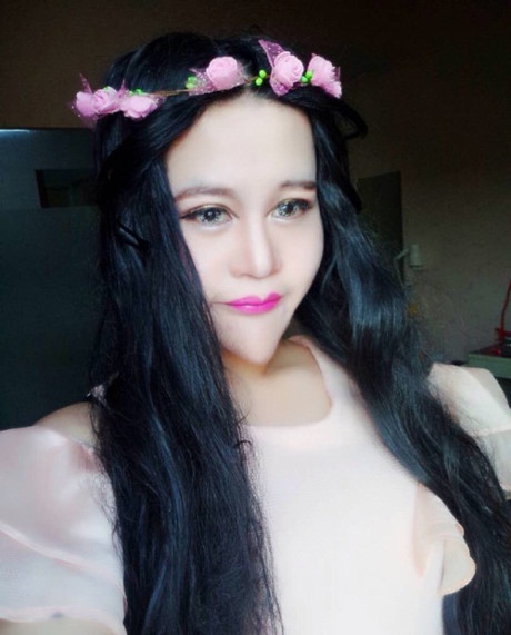 Cô gái TQ khiến mọi người sợ hãi vì khuôn mặt biến dị - Ảnh 2 Co gai TQ khien moi nguoi so hai vi khuon mat bien di - Anh 2