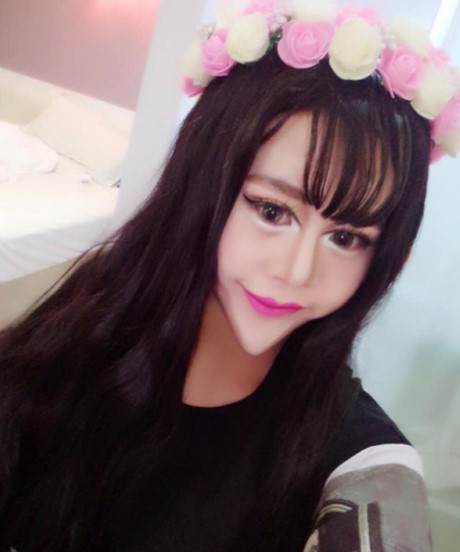 Cô gái TQ khiến mọi người sợ hãi vì khuôn mặt biến dị - Ảnh 4 Co gai TQ khien moi nguoi so hai vi khuon mat bien di - Anh 4