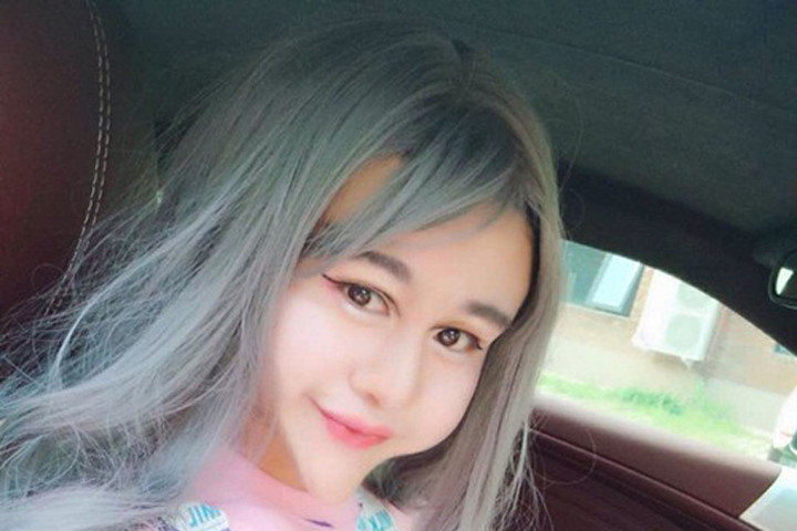 Cô gái Trung Quốc khiến mọi người sợ hãi vì khuôn mặt biến dị