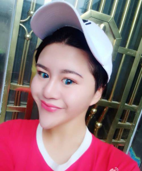 Cô gái TQ khiến mọi người sợ hãi vì khuôn mặt biến dị - Ảnh 7 Co gai TQ khien moi nguoi so hai vi khuon mat bien di - Anh 7