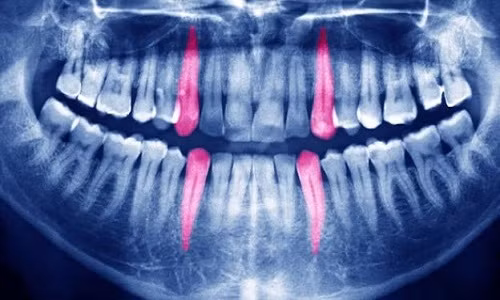 nhung-vu-rang-tu-phat-no-bi-n-trong-lich-su-1