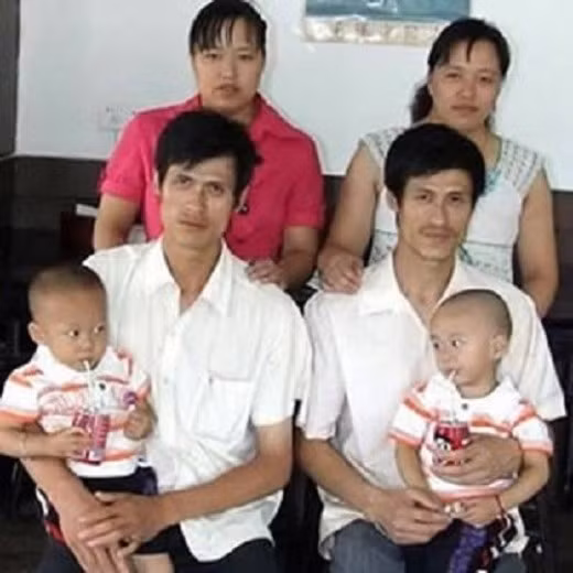 Chuyện lạ khó tin về các cặp song sinh trên thế giới ảnh 5