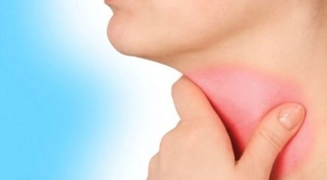 Mẹo đơn giản để thoát khỏi viêm họng