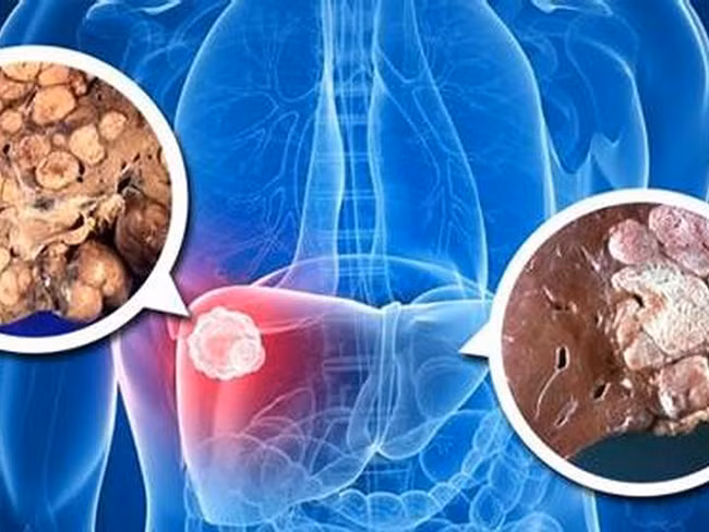 “Kẻ địch mạnh nhất” của độc tố gan mà chúng ta phải biết