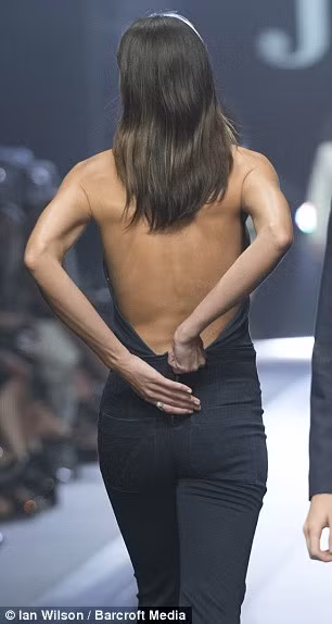 Người đẹp Úc gặp sự cố trang phục trên sân khấu ảnh 4