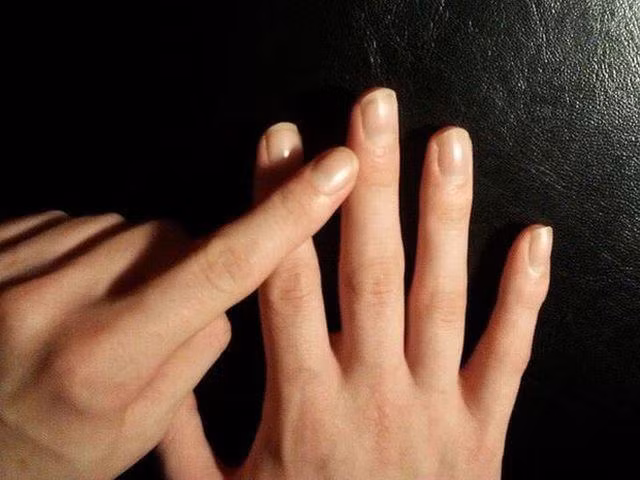 neu ngon tay xuat hien nhung dau hieu nay, canh giac ngay vi co the ban mac ung thu phoi - 5