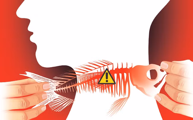 Chẳng may bị hóc xương cá, hãy áp dụng ngay những cách đơn giản và hiệu quả sau