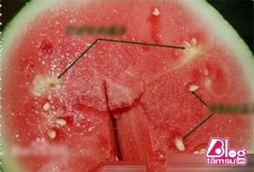 Cứ nhai cả hạt trắng trong dưa hấu kiểu này, 91% người Việt có thể chết dần chết mòn vì hiểm họa khôn lường bên trong