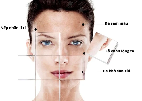 Dấu hiệu cảnh báo làn da đang hư tổn