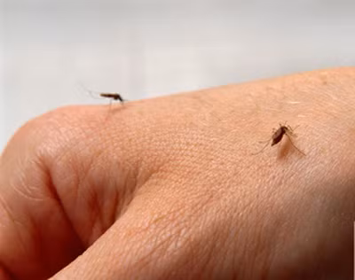 Bí quyết để muỗi đốt không bị ngứa, sưng tấy