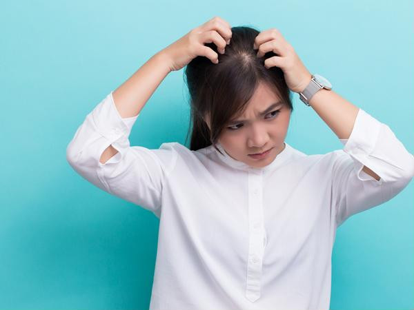 Thấy da đầu ngứa ngáy khó chịu, đừng vội chủ quan vì nó có thể là dấu hiệu của những căn bệnh sau ảnh 2
