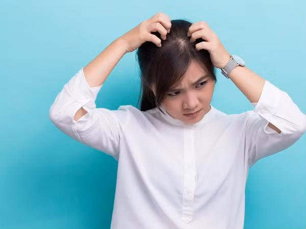 Thấy da đầu ngứa ngáy khó chịu, đừng vội chủ quan vì nó có thể là dấu hiệu của những căn bệnh sau ảnh 2