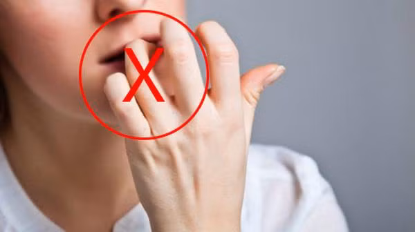 Xước măng rô: Ghi nhớ ngay cách xử lý đơn giản này kẻo hoại tử cả ngón tay ảnh 2