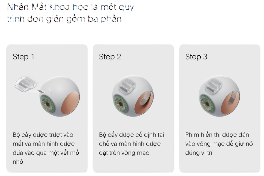 Quá trình lắp &quot;mắt khoa học&quot;