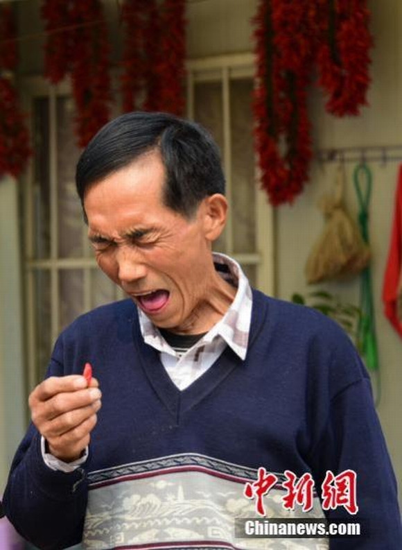 Người đàn ông ăn 2,5kg ớt cay mỗi ngày 3 Người đàn ông ăn 2,5kg ớt cay mỗi ngày 3