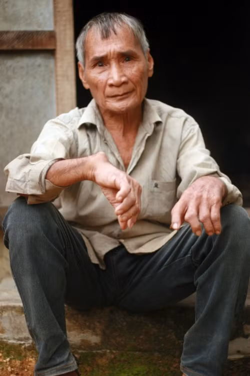 Ông Đinh Văn En cho PV xem bàn tay bị tật do vết thương lúc còn sống trong rừng để lại.