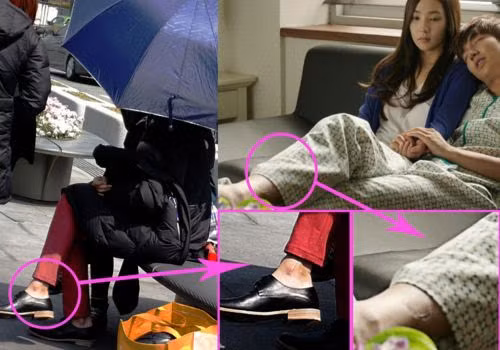 Những tai nạn kinh hoàng của Lee Min Ho, Jung Il Woo và loạt sao K-pop ảnh 3