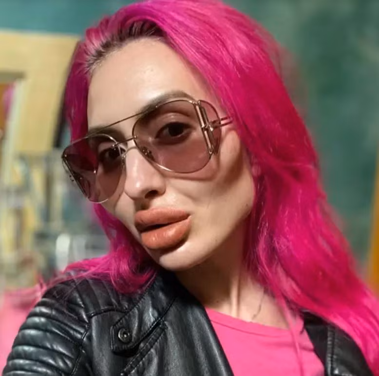 Người phụ nữ có đôi má lớn nhất thế giới vẫn muốn... phẫu thuật thẩm mỹ ảnh 3