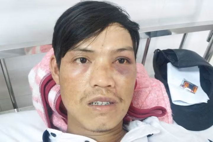 Anh Huy đang nằm điều trị tại bệnh viện. (Ảnh: Đ.Q)