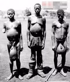 10 căn bệnh đáng sợ trong lịch sử loài người - Ảnh 9