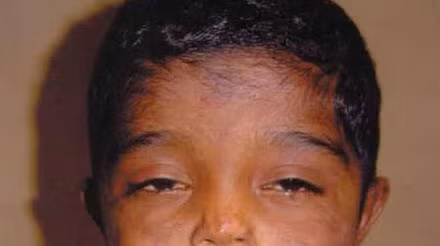 10 căn bệnh đáng sợ trong lịch sử loài người - Ảnh 2